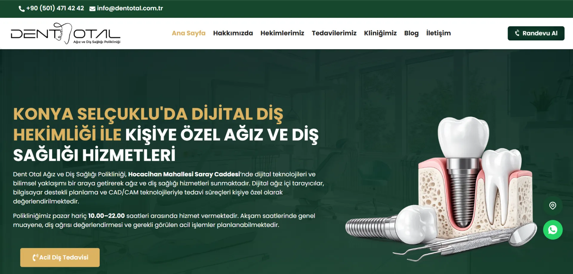 Dent Otal